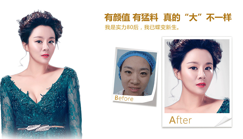 遵义脂肪移植、隆鼻