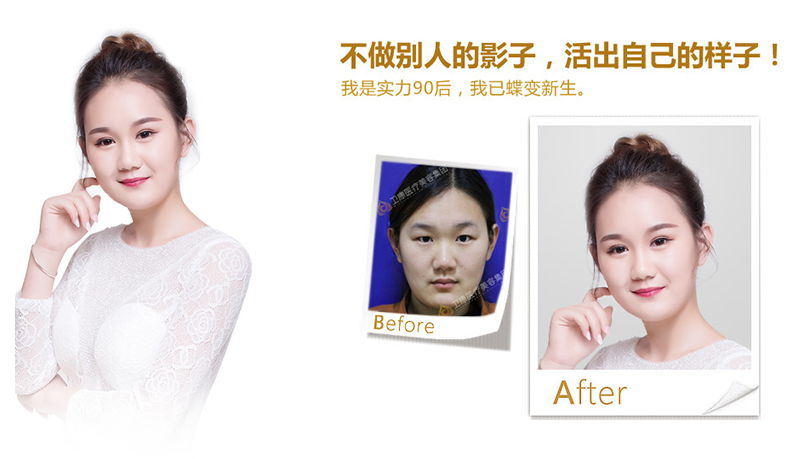 遵义纳米脂肪移植