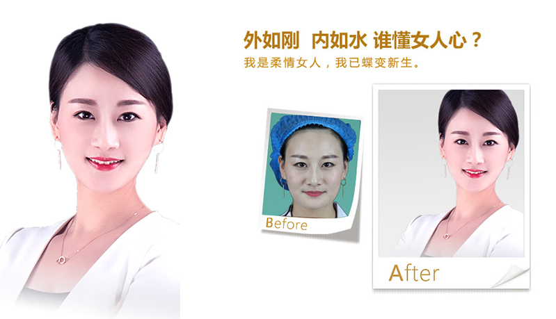 遵义V脸、线雕隆鼻